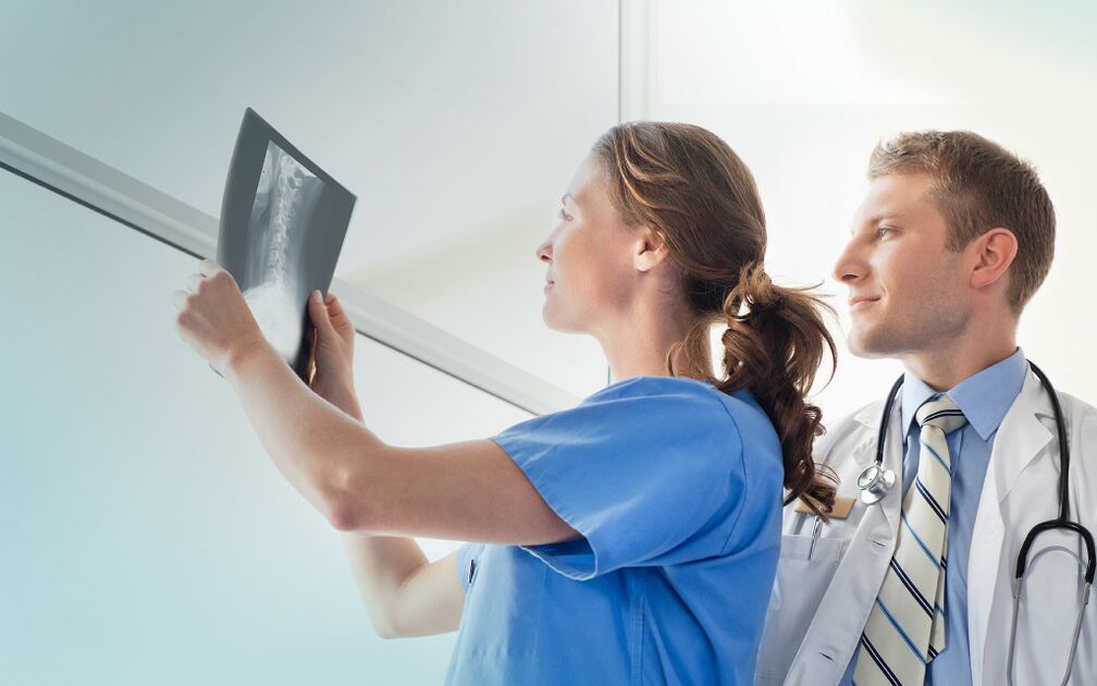 medicii care se uită la o radiografie pentru artroză
